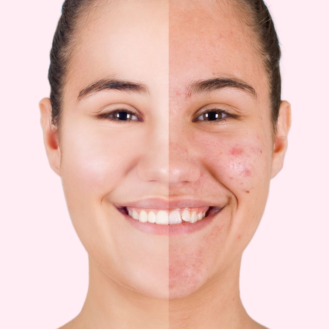 Potato Face Cleanser